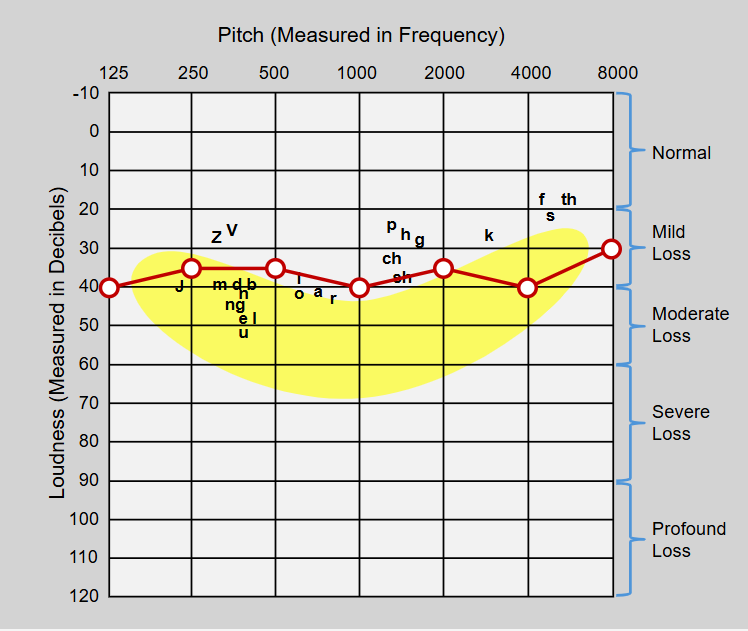 Audiogram